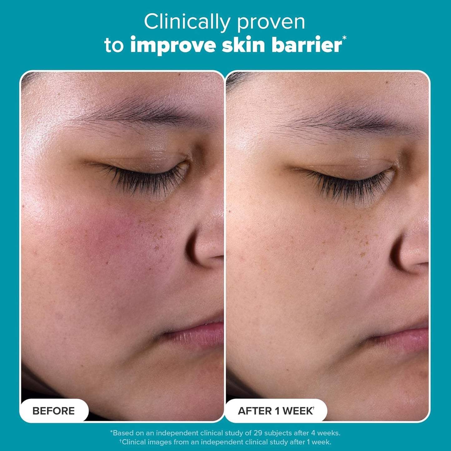 Paula’s Choice Skin Perfecting 2% BHA Liquid Exfoliant